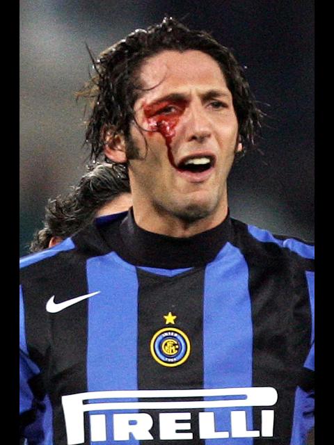 Marco Materazzi
